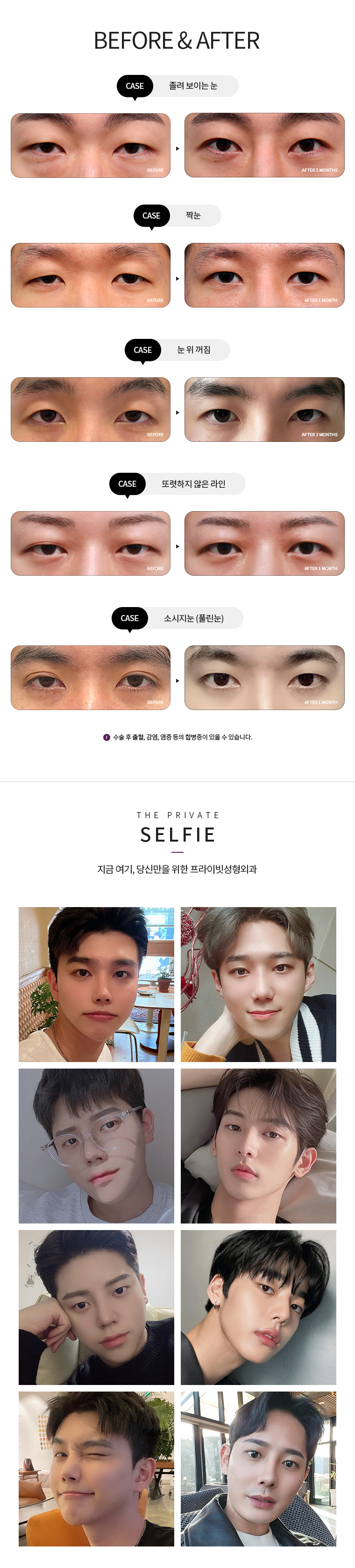 22코 모바일0